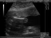 FeMuR dE Vicente