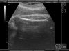 FeMuR Vicente 35 SeMaNaS